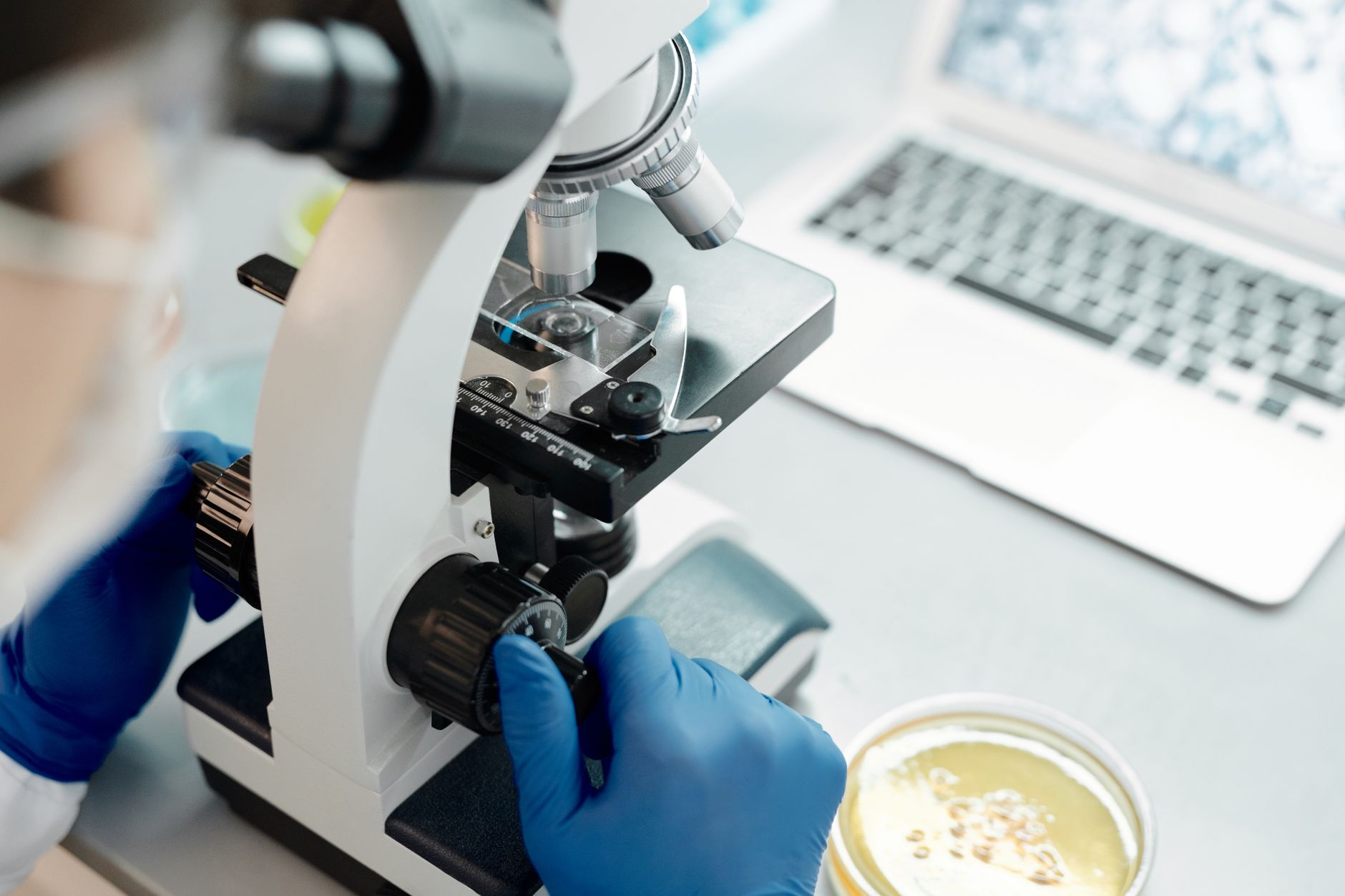 Deadly Brain-Targeting Mold Surges Across the United States
