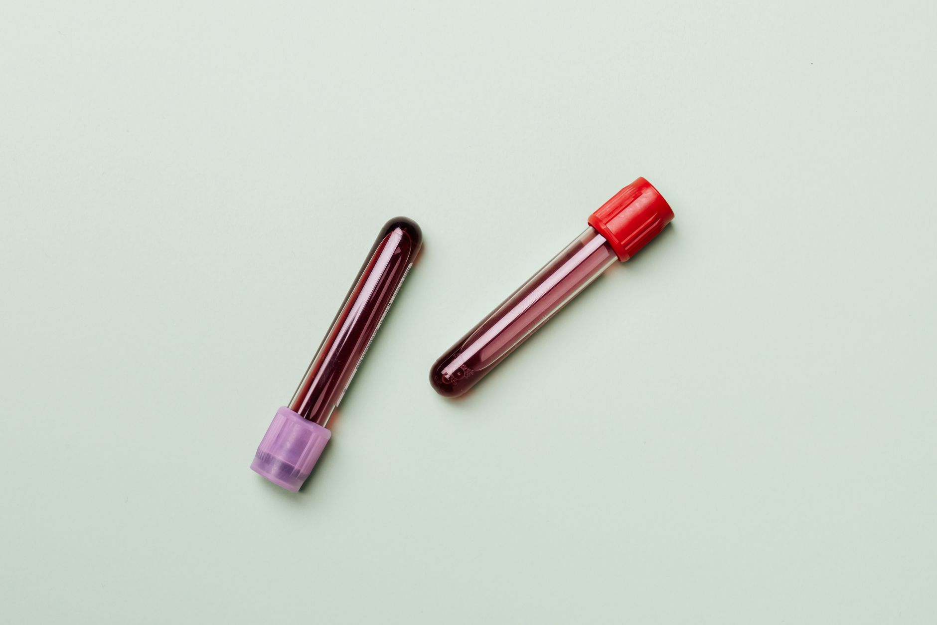 Landmark Clinical Study Seeks First Objective Blood Test for Major Depression