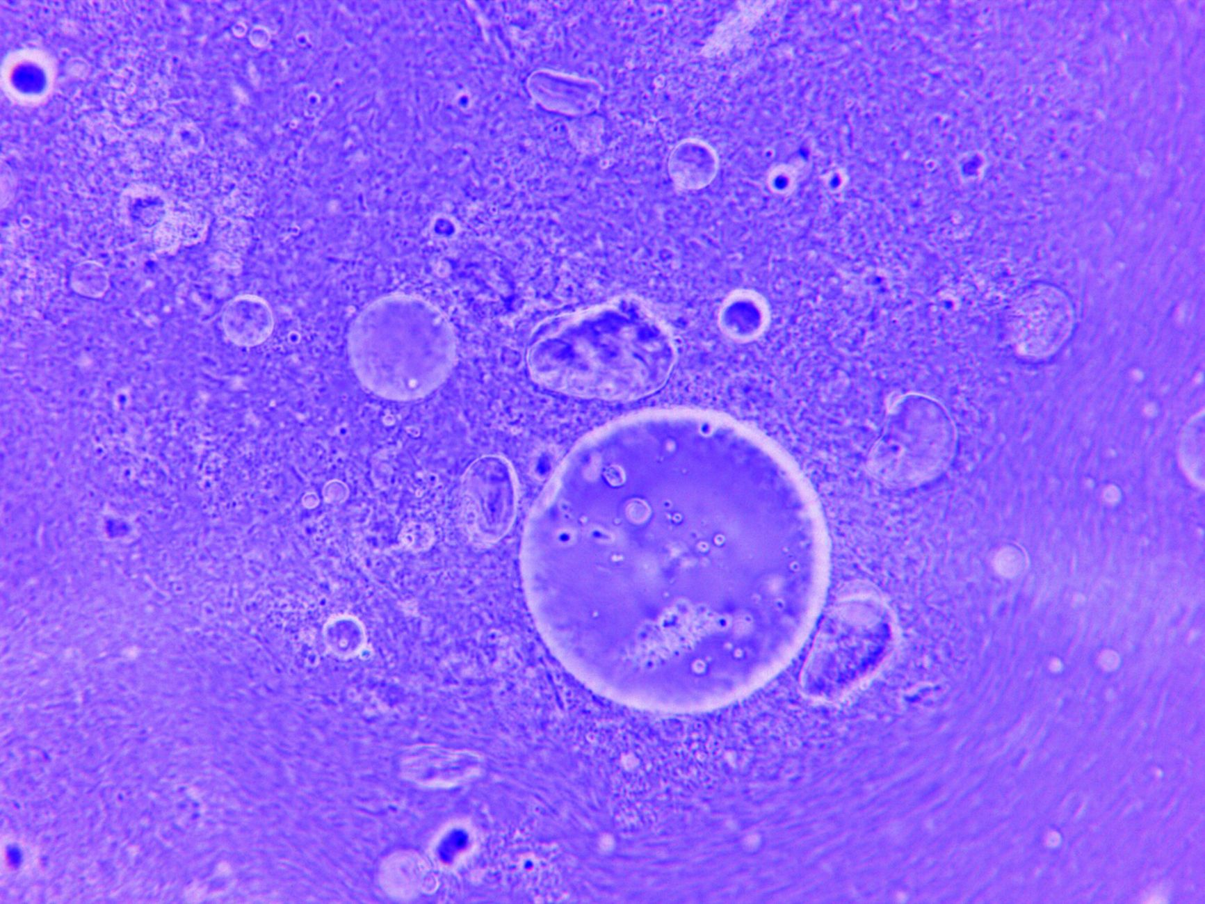 New Study Reveals Microplastics Generate Reactive Free Radicals in Water